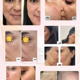 کرم روشن کننده و ضد لک تراست پروفشنال ،حجم۳۰میل