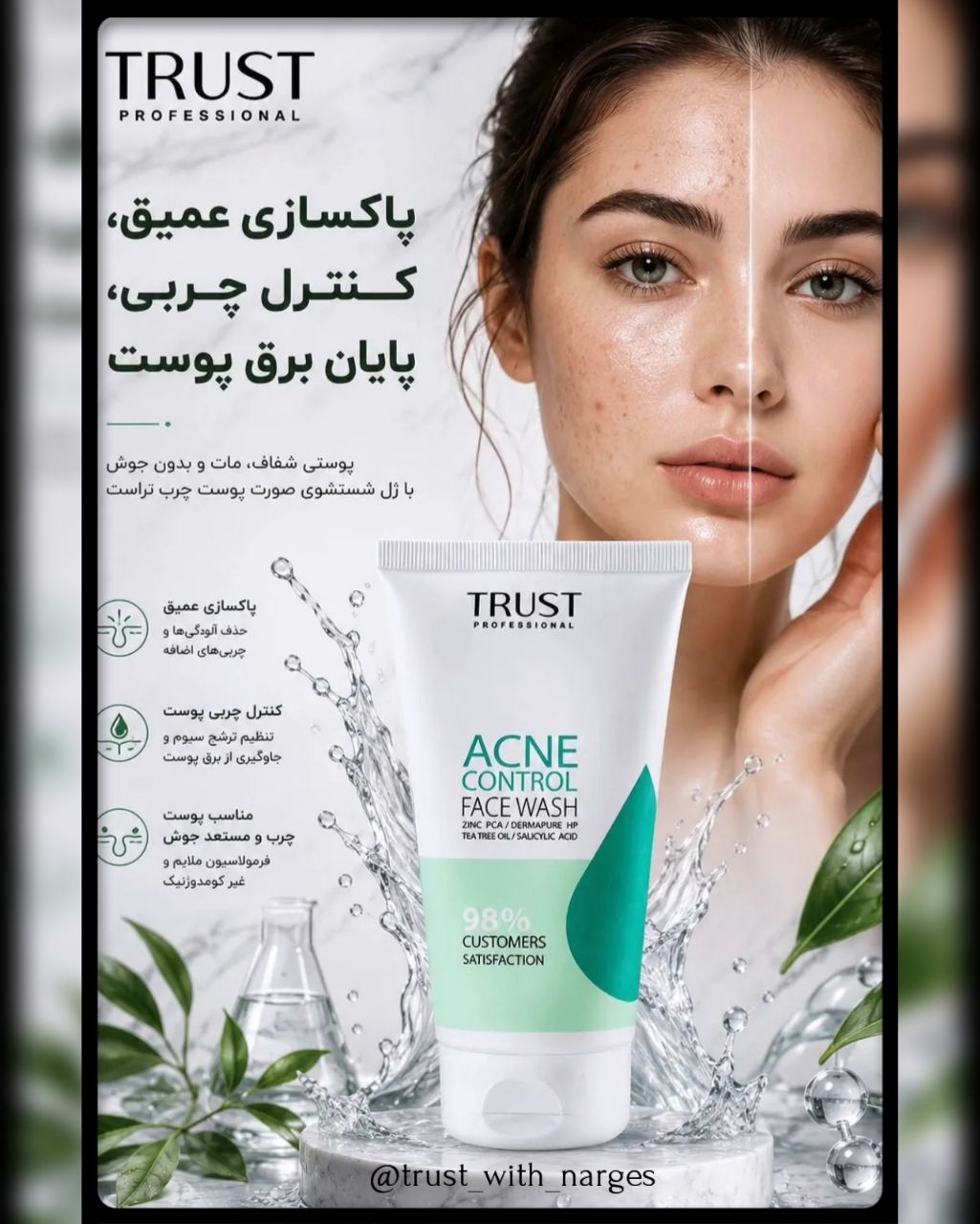 ژل شوینده کنترل آکنه تراست پروفشنال، حجم ۱۸۰میل