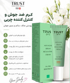 کرم ضد جوش وکنترل چربی تراست پروفشنال مناسب پوست چرب ،حجم ۳۰میل